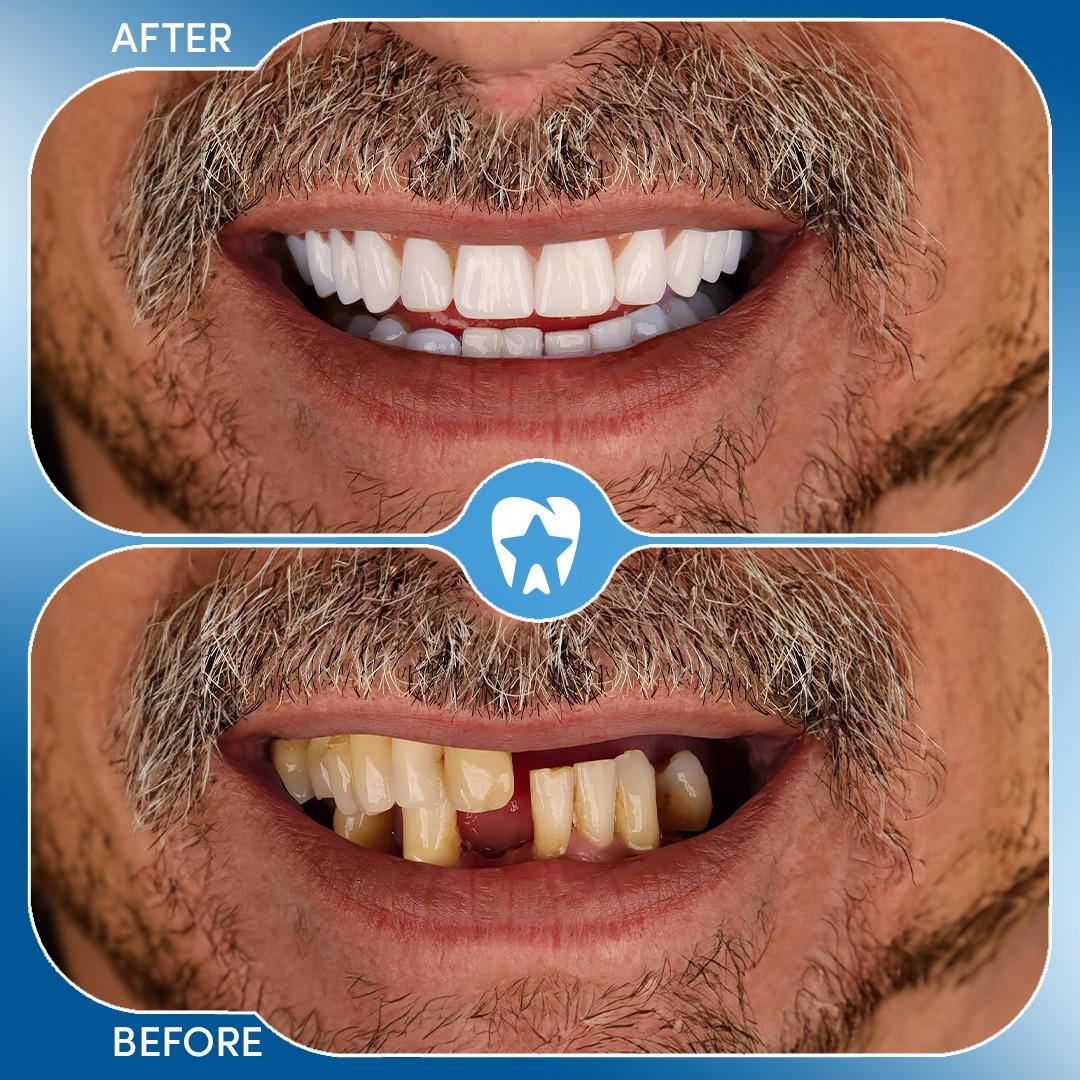 Before and after dental treatment